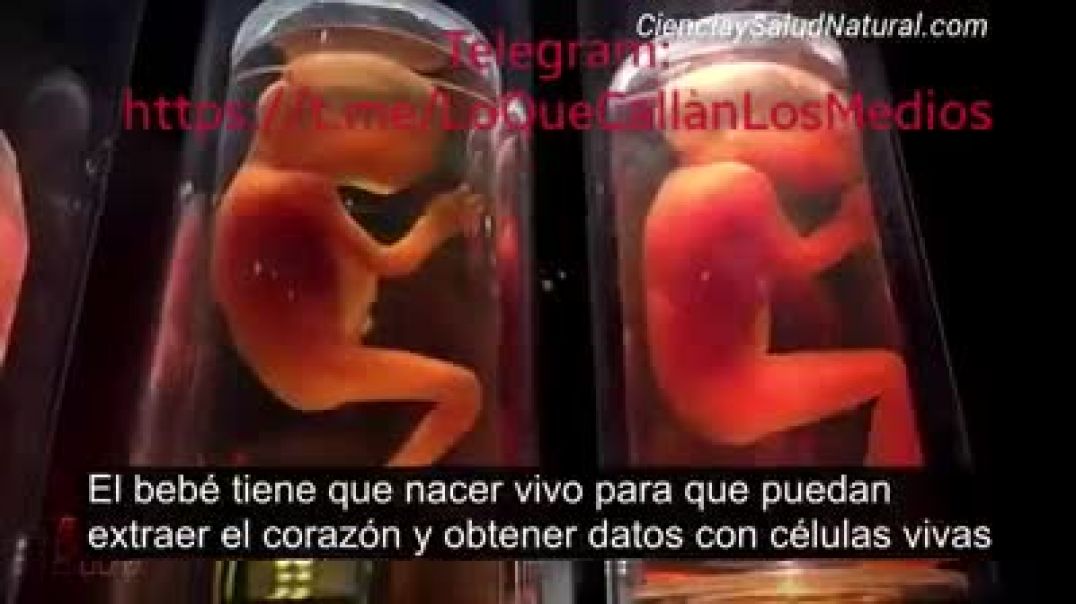 ABORTO LEGAL- EL NEGOCIO  DETRÁS DEL HORROR!!!